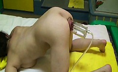Woman's prolapse sucked out of her ass with a pump