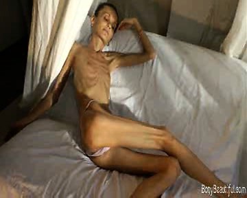 Extreme Skinny Porn - Extreme Bony Skinny Babe Shows Off Her Tiny Anorexic Body at Nuvid